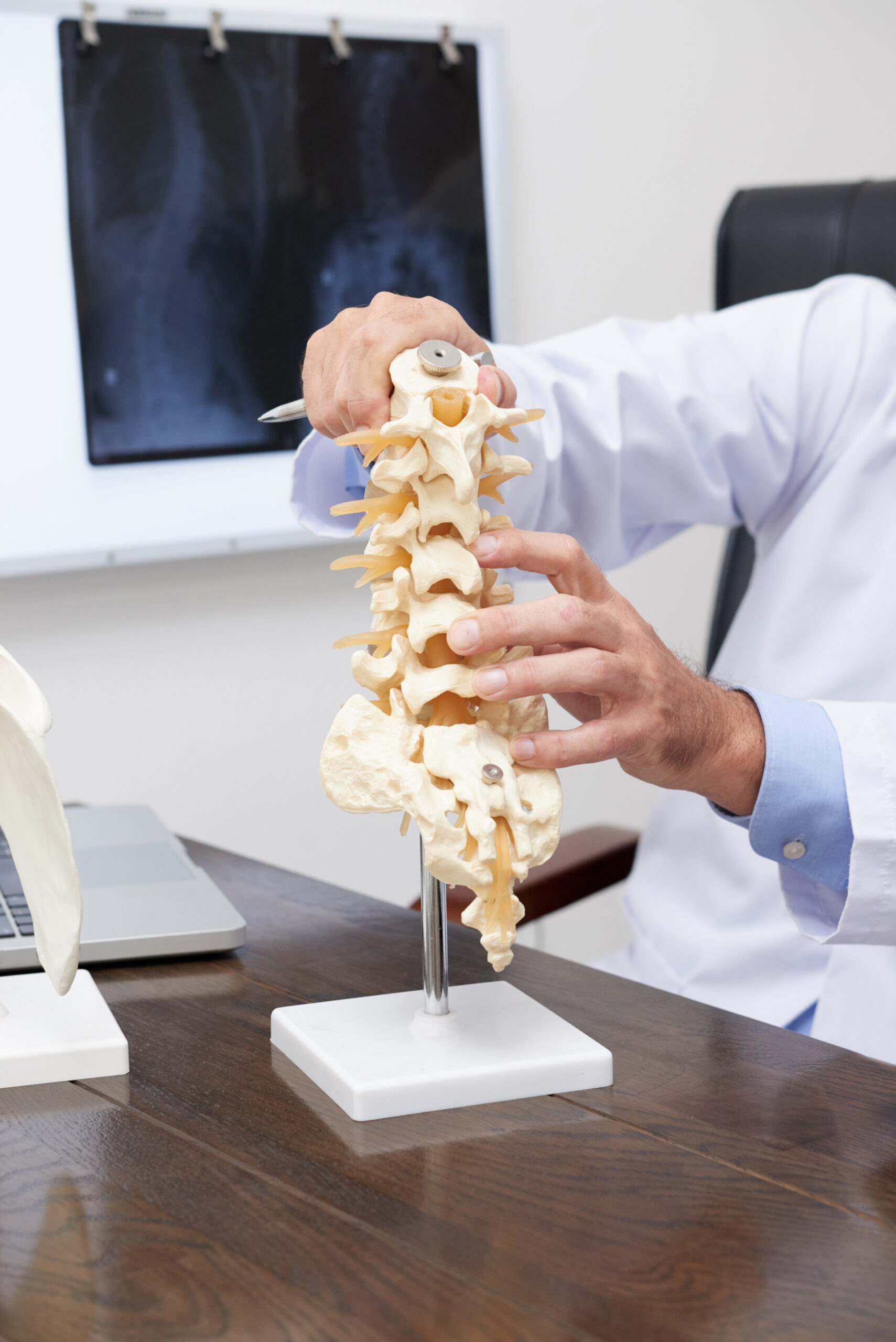 Lumbar Laminectomy Lumbar Laminectomy